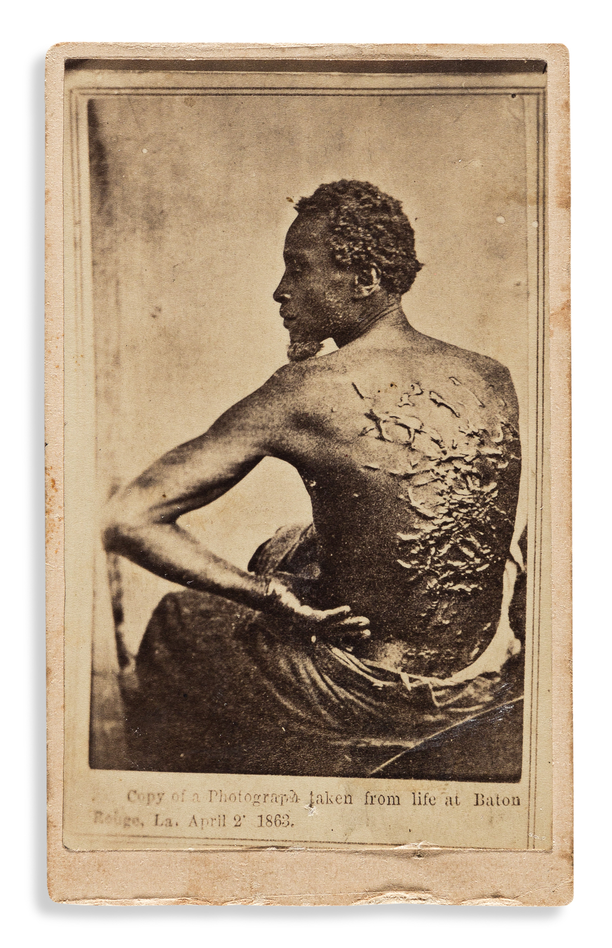 (SLAVERY AND ABOLITION.) [McPherson & Oliver; photographers.] [The Scourged Back.]